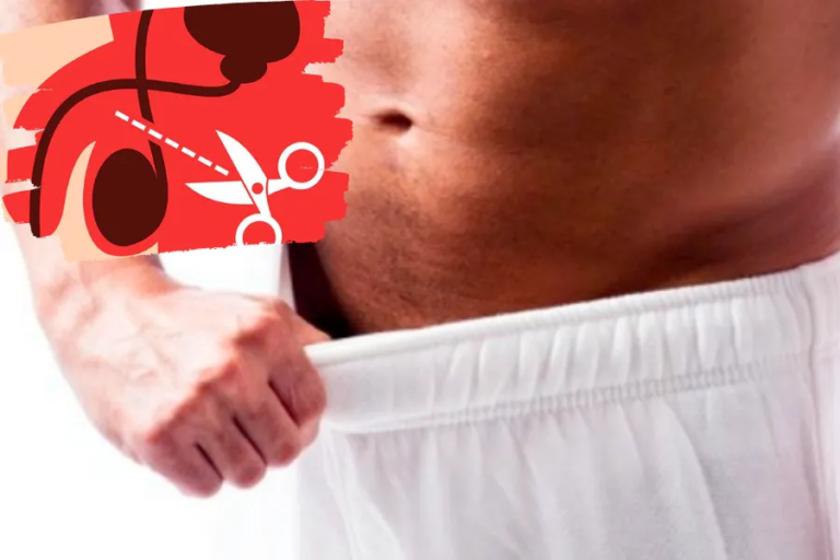 Đàn Ông Triệt Sản Có Ảnh Hưởng Tới Ham Muốn Không?