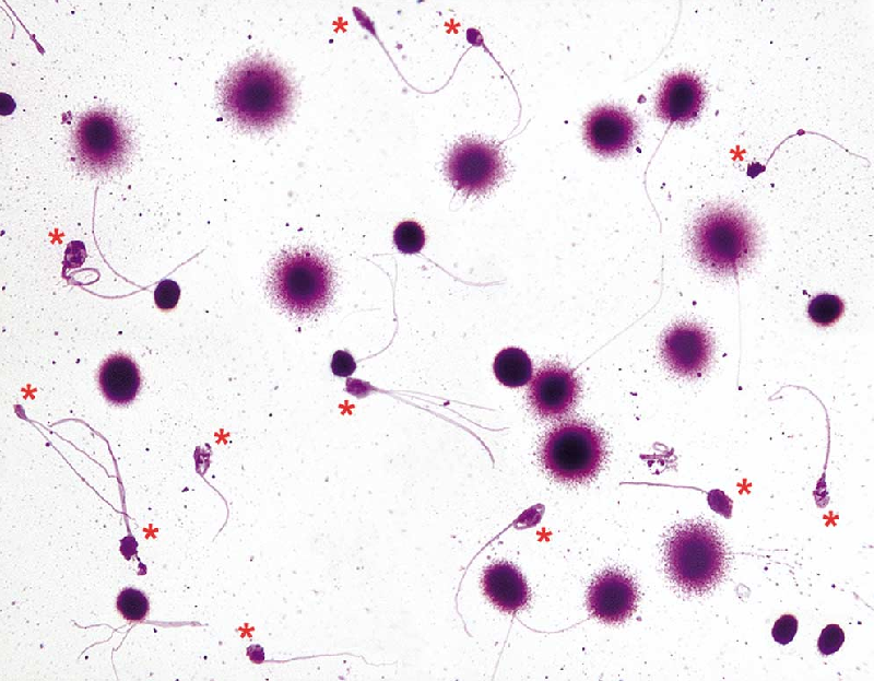 Phân Đoạn DNA Tinh Trùng