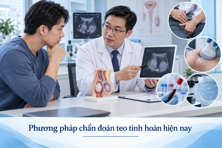 Teo tinh hoàn: Nguyên nhân, dấu hiệu và điều trị