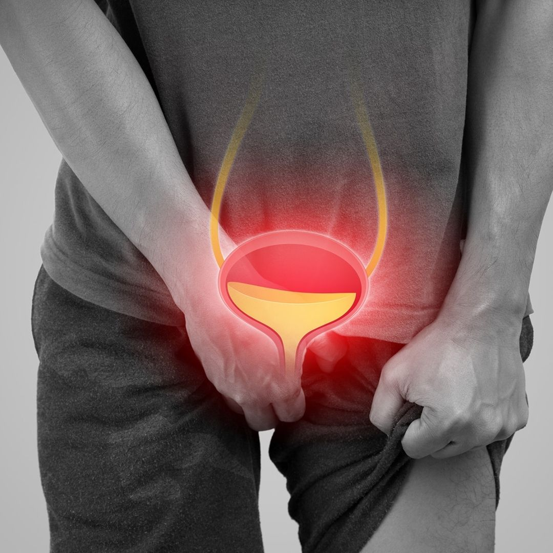 Nhiễm trùng tiết niệu: Nguyên nhân, dấu hiệu và giải pháp điều trị an toàn