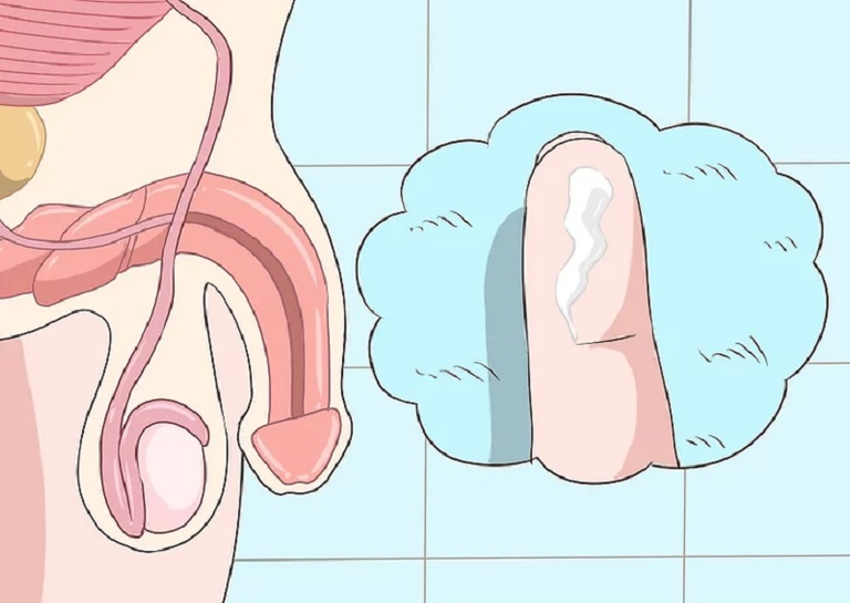 Bệnh lậu ở nam giới: Nguyên nhân, dấu hiệu, chẩn đoán và phác đồ điều trị chuẩn y khoa